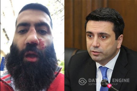 Ermənistan parlamentinin vitse-spikeri bloqerin burnunu dağıtdı